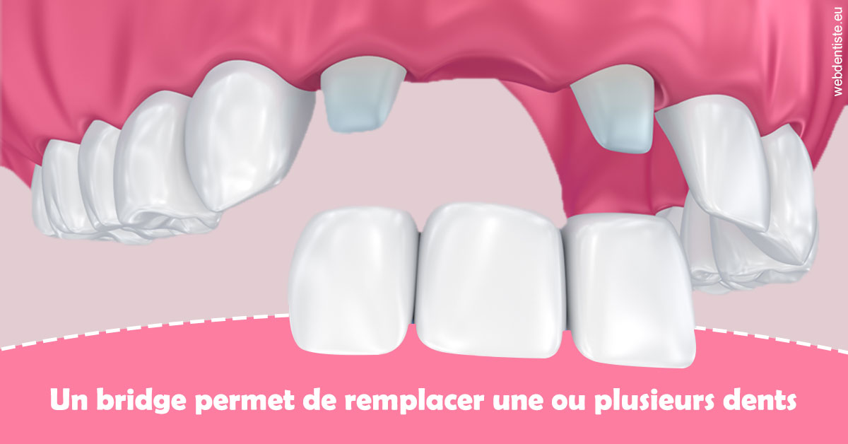 https://dr-naim-valerie.chirurgiens-dentistes.fr/Bridge remplacer dents 2