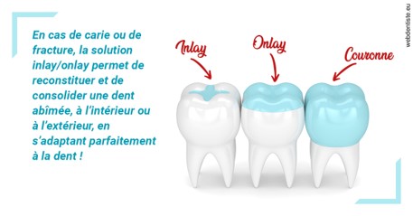 https://dr-naim-valerie.chirurgiens-dentistes.fr/L'INLAY ou l'ONLAY