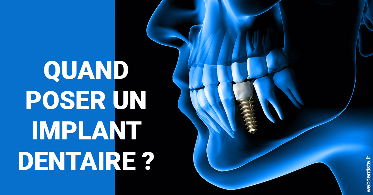https://dr-naim-valerie.chirurgiens-dentistes.fr/Les implants 1