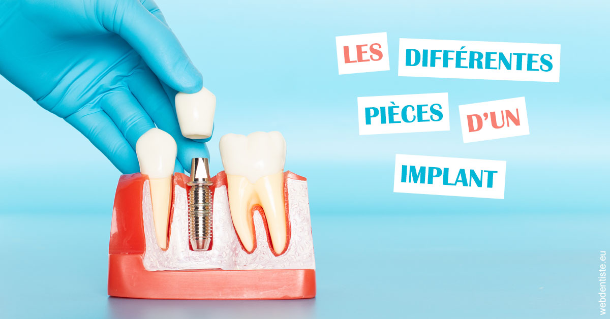https://dr-naim-valerie.chirurgiens-dentistes.fr/Les différentes pièces d’un implant 2