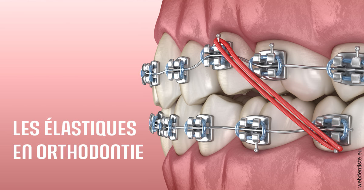https://dr-naim-valerie.chirurgiens-dentistes.fr/Elastiques orthodontie 2
