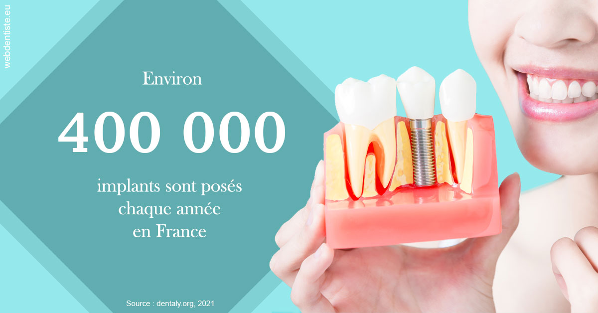 https://dr-naim-valerie.chirurgiens-dentistes.fr/Pose d'implants en France 2